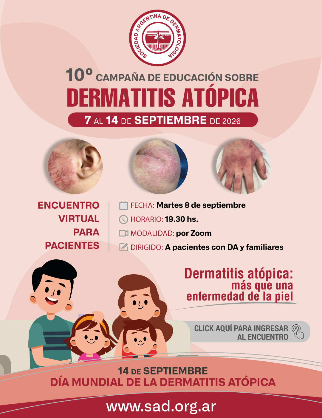 SAD-10-CAMPAÑA-DERMATITIS-ATOPICA