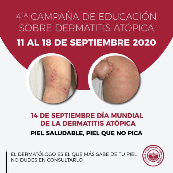Día Mundial de la DA